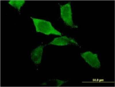 Immunocytochemistry/Immunofluorescence: ZBP1/DLM-1/DAI Antibody (2C10) [H00081030-M01] - Analysis of monoclonal antibody to ZBP1 on HeLa cell . Antibody concentration 10 ug/ml.