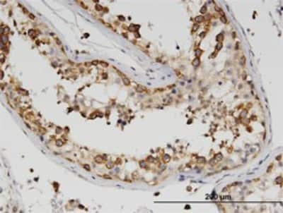 Immunohistochemistry-Paraffin: ZBP1/DLM-1/DAI Antibody (2C10) [H00081030-M01] - Analysis of monoclonal antibody to ZBP1 on formalin-fixed paraffin-embedded human testis. Antibody concentration 3 ug/ml.