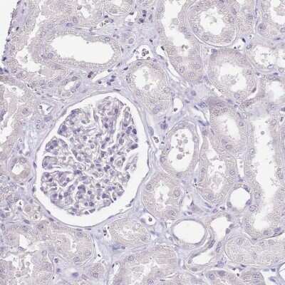 Immunohistochemistry-Paraffin: ZBP1/DLM-1/DAI Antibody [NBP2-14793] - Staining of human kidney shows low expression as expected.