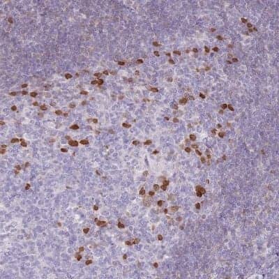 Immunohistochemistry-Paraffin: ZBP1/DLM-1/DAI Antibody [NBP2-14793] - Staining of human tonsil shows high expression.