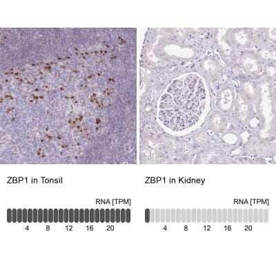 <b>Orthogonal Strategies Validation. </b>Immunohistochemistry-Paraffin: ZBP1/DLM-1/DAI Antibody [NBP2-14793] - Staining in human tonsil and kidney tissues using anti-ZBP1 antibody. Corresponding ZBP1 RNA-seq data are presented for the same tissues.