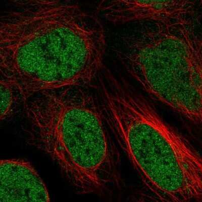 Immunocytochemistry/ Immunofluorescence ZBTB10 Antibody