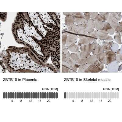 Immunohistochemistry-Paraffin: ZBTB10 Antibody [NBP1-83714] - Staining in human placenta and skeletal muscle tissues using anti-ZBTB10 antibody. Corresponding ZBTB10 RNA-seq data are presented for the same tissues.