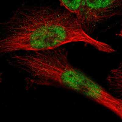 Immunocytochemistry/ Immunofluorescence ZBTB11 Antibody