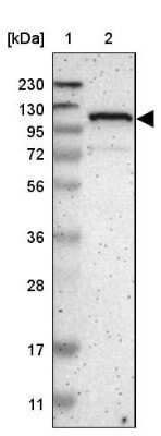 Western Blot ZBTB11 Antibody