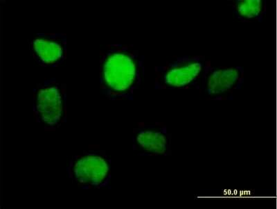 Immunocytochemistry/Immunofluorescence: ZBTB14 Antibody [H00007541-B01P] - Analysis of purified antibody to ZFP161 on HeLa cell. (antibody concentration 10 ug/ml)