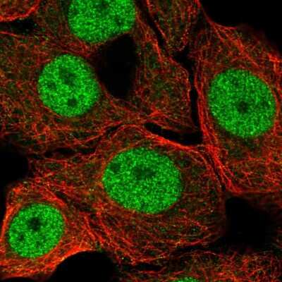 Immunocytochemistry/Immunofluorescence: ZBTB14 Antibody [NBP2-47576] - Immunofluorescent staining of human cell line MCF7 shows localization to nucleoplasm.