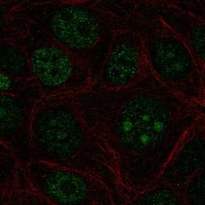 Immunocytochemistry/Immunofluorescence: ZBTB14 Antibody [NBP2-57846] - Staining of human cell line MCF7 shows localization to nucleus & nucleoli.