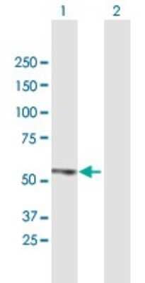 Western Blot: ZBTB14 Antibody [H00007541-B01P] - Analysis of ZFP161 expression in transfected 293T cell line by ZFP161 polyclonal antibody.  Lane 1: ZFP161 transfected lysate(49.39 KDa). Lane 2: Non-transfected lysate.