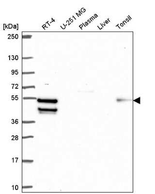 Western Blot: ZBTB14 Antibody [NBP2-57846] - Analysis in human cell line RT-4, human cell line U-251 MG, human plasma, human liver tissue and human tonsil tissue.