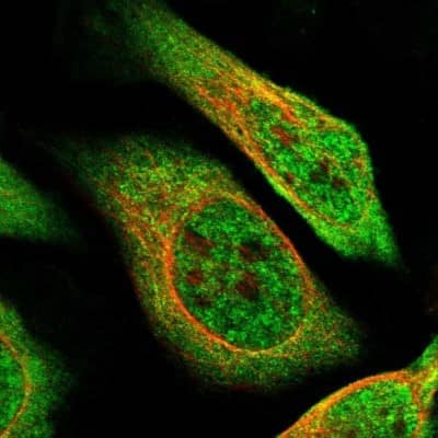 Immunocytochemistry/Immunofluorescence: ZBTB2 Antibody [NBP1-88786] - Immunofluorescent staining of human cell line U-2 OS shows localization to nucleoplasm & cytosol.