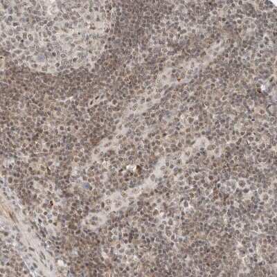 Immunohistochemistry-Paraffin: ZBTB2 Antibody [NBP1-88787] - Staining of human tonsil shows weak nuclear positivity in non-germinal center cells.