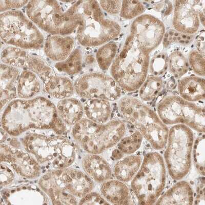 Immunohistochemistry-Paraffin: ZBTB2 Antibody [NBP1-88786] - Staining of human kidney shows moderate cytoplasmic and nuclear positivity in tubule cells.