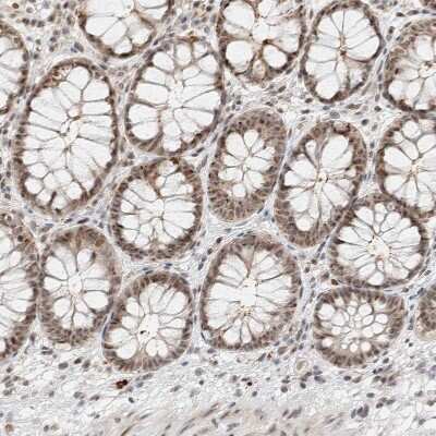 Immunohistochemistry-Paraffin: ZBTB2 Antibody [NBP1-88787] - Staining of human rectum shows weak to moderate nuclear positivity in glandular cells.