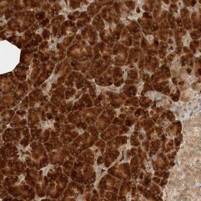 Immunohistochemistry-Paraffin: ZBTB2 Antibody [NBP1-88788] - Staining of human pancreas shows strong cytoplasmic positivity in exocrine glandular cells.