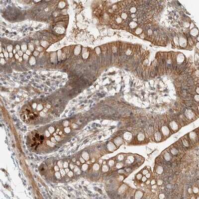 Immunohistochemistry-Paraffin: ZBTB2 Antibody [NBP1-88789] - Staining of human small intestine shows strong positivity in paneth cells.