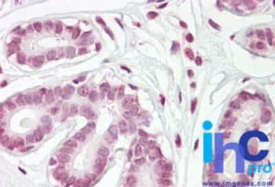 Immunohistochemistry-Paraffin ZBTB2 Antibody