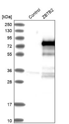 Western Blot: ZBTB2 Antibody [NBP1-88786] - Analysis in control (vector only transfected HEK293T lysate) and ZBTB2 over-expression lysate (Co-expressed with a C-terminal myc-DDK tag (3.1 kDa) in mammalian HEK293T cells).