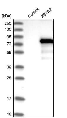 Western Blot: ZBTB2 Antibody [NBP1-88788] - Analysis in control (vector only transfected HEK293T lysate) and ZBTB2 over-expression lysate (Co-expressed with a C-terminal myc-DDK tag (3.1 kDa) in mammalian HEK293T cells).