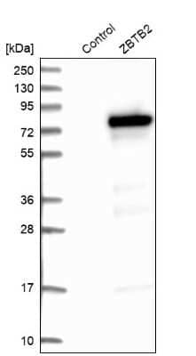 Western Blot: ZBTB2 Antibody [NBP1-88789] - Analysis in control (vector only transfected HEK293T lysate) and ZBTB2 over-expression lysate (Co-expressed with a C-terminal myc-DDK tag (3.1 kDa) in mammalian HEK293T cells).