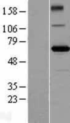 Western Blot ZBTB2 Overexpression Lysate