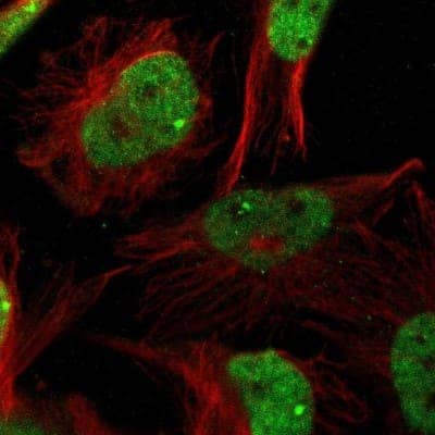 Immunocytochemistry/Immunofluorescence: ZBTB20 Antibody [NBP1-84146] - Staining of human cell line U-251 MG shows localization to nucleoplasm & nuclear bodies. Antibody staining is shown in green. 