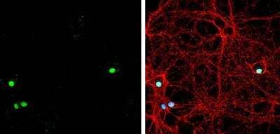 Immunocytochemistry/Immunofluorescence: ZBTB20 Antibody [NBP2-20936] - DIV9 rat E18 primary hippocampal neuron cells were fixed in 4% paraformaldehyde at RT for 15 min. Green: ZBTB20 stained by ZBTB20 antibody  diluted at 1:500.Red: beta Tubulin 3/ Tuj1, stained by beta Tubulin 3/ Tuj1 antibody [1338] diluted at 1:500. Blue: Fluoroshield with DAPI. 