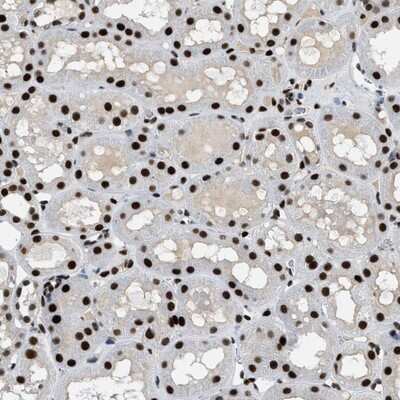 Immunohistochemistry-Paraffin: ZBTB20 Antibody [NBP1-84146] - Staining of human kidney shows strong nuclear positivity in tubule cells.