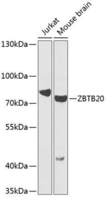 Western Blot: ZBTB20 Antibody [NBP2-93684] - Analysis of extracts of various cell lines, using ZBTB20 at 1:1000 dilution. Secondary antibody: HRP Goat Anti-Rabbit IgG (H+L) at 1:10000 dilution. Lysates/proteins: 25ug per lane. Blocking buffer: 3% nonfat dry milk in TBST. Detection: ECL Basic Kit . Exposure time: 90s.