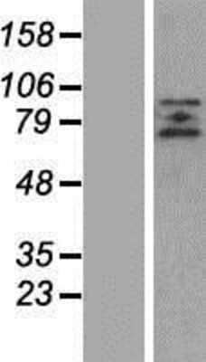 Western Blot: ZBTB20 Overexpression Lysate (Adult Normal) [NBP2-10211] Left-Empty vector transfected control cell lysate (HEK293 cell lysate); Right -Over-expression Lysate for ZBTB20.