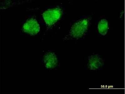 Immunocytochemistry/Immunofluorescence: ZBTB26 Antibody [H00057684-B01P] - Analysis of purified antibody to ZBTB26 on HeLa cell. (antibody concentration 10 ug/ml)
