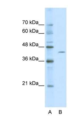 Western Blot: ZBTB26 Antibody [NBP1-80120] - Jurkat cell lysate, concentration 0.2-1 ug/ml.
