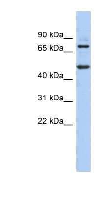 Western Blot: ZBTB26 Antibody [NBP1-80350] - PANC1 cell lysate, concentration 0.2-1 ug/ml.