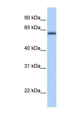 Western Blot: ZBTB26 Antibody [NBP1-80351] - Human Heart lysate, concentration 0.2-1 ug/ml.