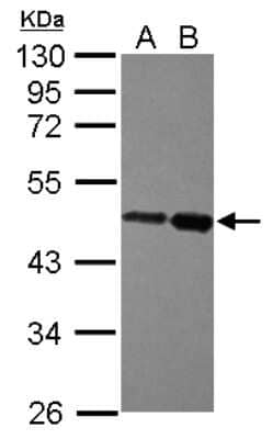 Western Blot: ZBTB26 Antibody [NBP2-20937] - Sample (30 ug of whole cell lysate) A: NT2D1 B: IMR32 10% SDS PAGE gel, diluted at 1:5000.