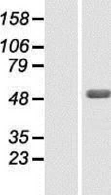 Western Blot: ZBTB26 Overexpression Lysate (Adult Normal) [NBP2-06592] Left-Empty vector transfected control cell lysate (HEK293 cell lysate); Right -Over-expression Lysate for ZBTB26.