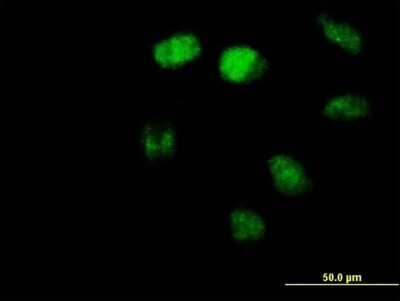 Immunocytochemistry/Immunofluorescence: ZBTB3 Antibody [H00079842-B01P] - Analysis of purified antibody to ZBTB3 on HeLa cell. (antibody concentration 10 ug/ml)