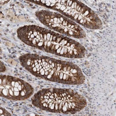 Immunohistochemistry ZBTB3 Antibody - BSA Free