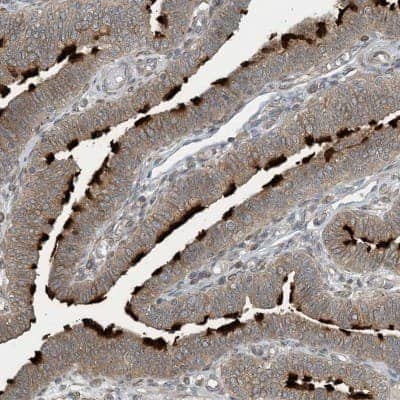 Immunohistochemistry-Paraffin ZBTB3 Antibody - BSA Free
