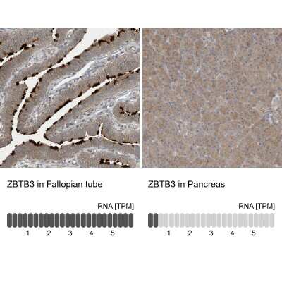 Immunohistochemistry-Paraffin ZBTB3 Antibody - BSA Free