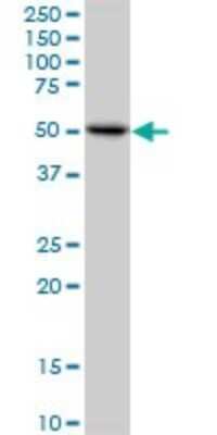 Western Blot: ZBTB3 Antibody [H00079842-B01P] - Analysis of ZBTB3 expression in K-562.