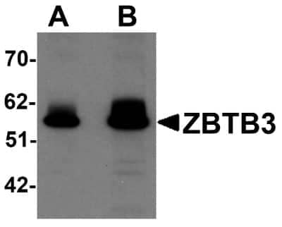 Western Blot: ZBTB3 Antibody [NBP1-76516] - Rat brain tissue lysate with ZBTB3 antibody at (A) 1 and (B) 2 ug/mL.