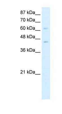 Western Blot: ZBTB3 Antibody [NBP1-80367] - HepG2 cell lysate, concentration 0.2-1 ug/ml.