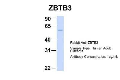 Western Blot: ZBTB3 Antibody [NBP1-80368] - Sample Type: Human Adult Placenta Antibody Dilution: 1.0 ug/ml