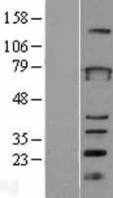 Western Blot: ZBTB3 Overexpression Lysate (Adult Normal) [NBL1-17968] Left-Empty vector transfected control cell lysate (HEK293 cell lysate); Right -Over-expression Lysate for ZBTB3.