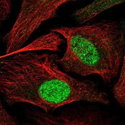 Immunocytochemistry/Immunofluorescence: ZBTB34 Antibody [NBP1-93562] - Immunofluorescent staining of human cell line U-2 OS shows localization to nucleoplasm. Antibody staining is shown in green.