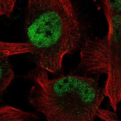 Immunocytochemistry/Immunofluorescence: ZBTB38 Antibody [NBP2-55733] - Staining of human cell line U-251 MG shows localization to nucleoplasm.