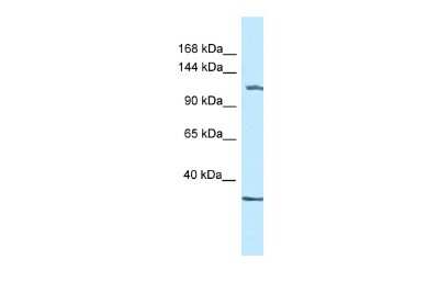 Western Blot: ZBTB38 Antibody [NBP2-88605] - WB Suggested Anti-Zbtb38 Antibody. Titration: 1.0 ug/ml. Positive Control: Mouse Kidney