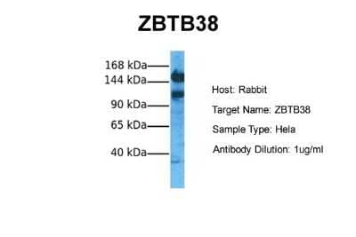 Western Blot: ZBTB38 Antibody [NBP2-88606] - Host: Rabbit. Target Name: ZBTB38. Sample Tissue: Human Hela. Antibody Dilution: 1.0ug/ml