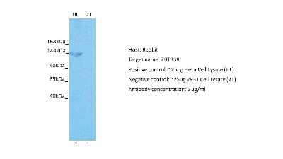 Western Blot: ZBTB38 Antibody [NBP2-88606] - Host: Rabbit. Target: ZBTB38. Positive control (+): HeLa Cell Lysate (HL). Negative control (-): 293T Cell Lysate (2T). Antibody concentration: 3ug/ml